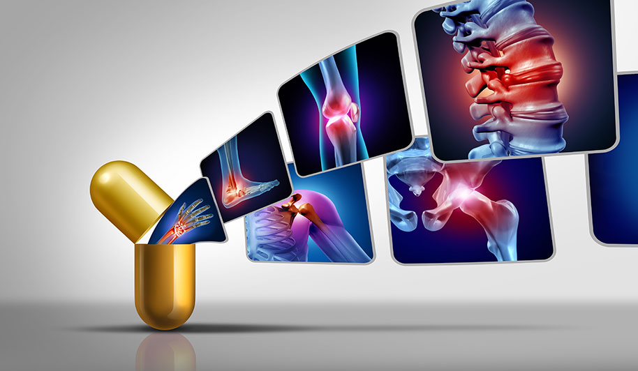 New generation Osteoarthritis Treatment: Microneedle Arrays for Regeneration and More